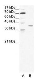 C/EBP zeta Antibody in Western Blot (WB)