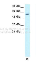 HLX Antibody in Western Blot (WB)