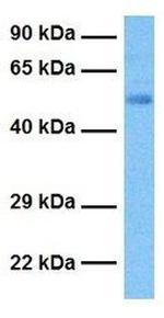HLX Antibody in Western Blot (WB)
