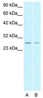 ZNF174 Antibody in Western Blot (WB)