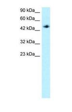 MAPKAPK2 Antibody in Western Blot (WB)