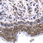 GTF2F2 Antibody in Immunohistochemistry (IHC)