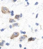 GTF2F2 Antibody in Immunohistochemistry (IHC)