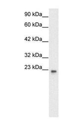 GTF2F2 Antibody in Western Blot (WB)