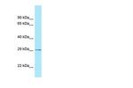 CDX2 Antibody in Western Blot (WB)