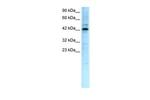 TCFL5 Antibody in Western Blot (WB)