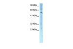 ZNF500 Antibody in Western Blot (WB)