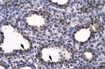 HMGB2 Antibody in Immunohistochemistry (Paraffin) (IHC (P))