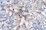 NR4A1 Antibody in Immunohistochemistry (Paraffin) (IHC (P))