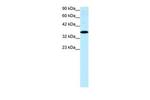 NR4A1 Antibody in Western Blot (WB)