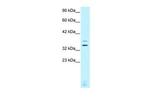 CHX10 Antibody in Western Blot (WB)