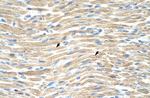 LMX1A Antibody in Immunohistochemistry (Paraffin) (IHC (P))