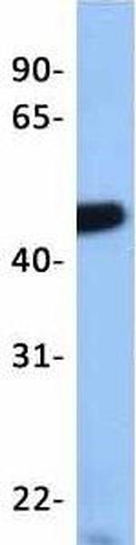 LMX1A Antibody in Western Blot (WB)