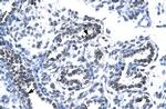 RUVBL2 Antibody in Immunohistochemistry (Paraffin) (IHC (P))