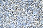 ASGR2 Antibody in Immunohistochemistry (Paraffin) (IHC (P))