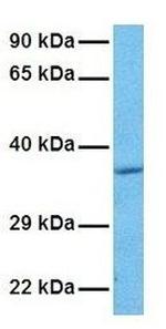 ASGR2 Antibody in Western Blot (WB)