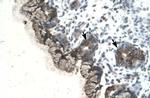 PARP3 Antibody in Immunohistochemistry (Paraffin) (IHC (P))