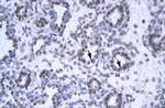 GAS41 Antibody in Immunohistochemistry (Paraffin) (IHC (P))