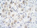 GAS41 Antibody in Immunohistochemistry (Paraffin) (IHC (P))