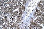 MMP19 Antibody in Immunohistochemistry (Paraffin) (IHC (P))