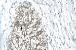 MMP19 Antibody in Immunohistochemistry (Paraffin) (IHC (P))