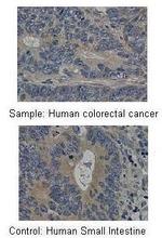 MMP19 Antibody in Immunohistochemistry (Paraffin) (IHC (P))