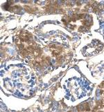 SLC17A3 Antibody in Immunohistochemistry (IHC)