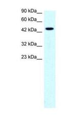 SLC17A3 Antibody in Western Blot (WB)