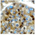 PIT1 Antibody in Immunohistochemistry (Paraffin) (IHC (P))