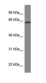 HOXD3 Antibody in Western Blot (WB)