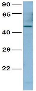 PAX4 Antibody in Western Blot (WB)