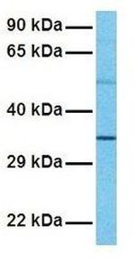 PAX4 Antibody in Western Blot (WB)
