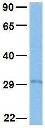 PAX4 Antibody in Western Blot (WB)