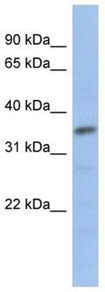 MYF5 Antibody in Western Blot (WB)