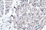 FOXE3 Antibody in Immunohistochemistry (Paraffin) (IHC (P))