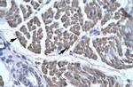 EYA3 Antibody in Immunohistochemistry (Paraffin) (IHC (P))