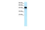 EYA3 Antibody in Western Blot (WB)
