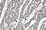 SMAD6 Antibody in Immunohistochemistry (Paraffin) (IHC (P))