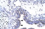 SMAD6 Antibody in Immunohistochemistry (Paraffin) (IHC (P))