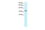 SMAD6 Antibody in Western Blot (WB)