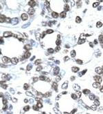 CITED1 Antibody in Immunohistochemistry (IHC)