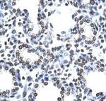 CITED1 Antibody in Immunohistochemistry (IHC)