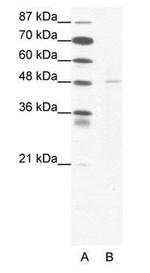 DEK Antibody in Western Blot (WB)