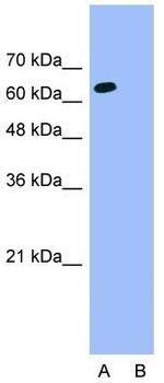 ThPOK Antibody in Western Blot (WB)