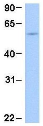 ThPOK Antibody in Western Blot (WB)