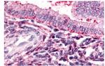 TBXA2R Antibody in Immunohistochemistry (Paraffin) (IHC (P))