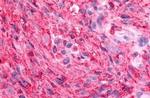 GPR88 Antibody in Immunohistochemistry (Paraffin) (IHC (P))