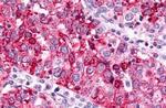 GPR88 Antibody in Immunohistochemistry (Paraffin) (IHC (P))