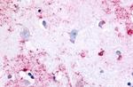 PAK6 Antibody in Immunohistochemistry (Paraffin) (IHC (P))
