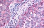 PAK6 Antibody in Immunohistochemistry (Paraffin) (IHC (P))